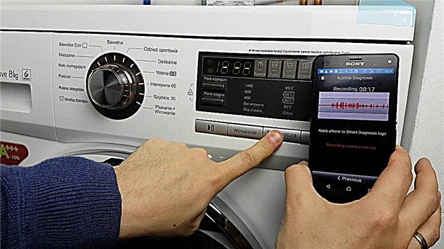 What is smart diagnostics in the LG washing machine