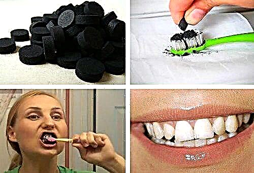Cum să albiți dinții cu cărbune activat?